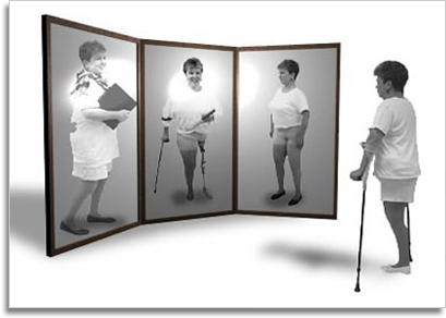 Vancouver Prosthetics